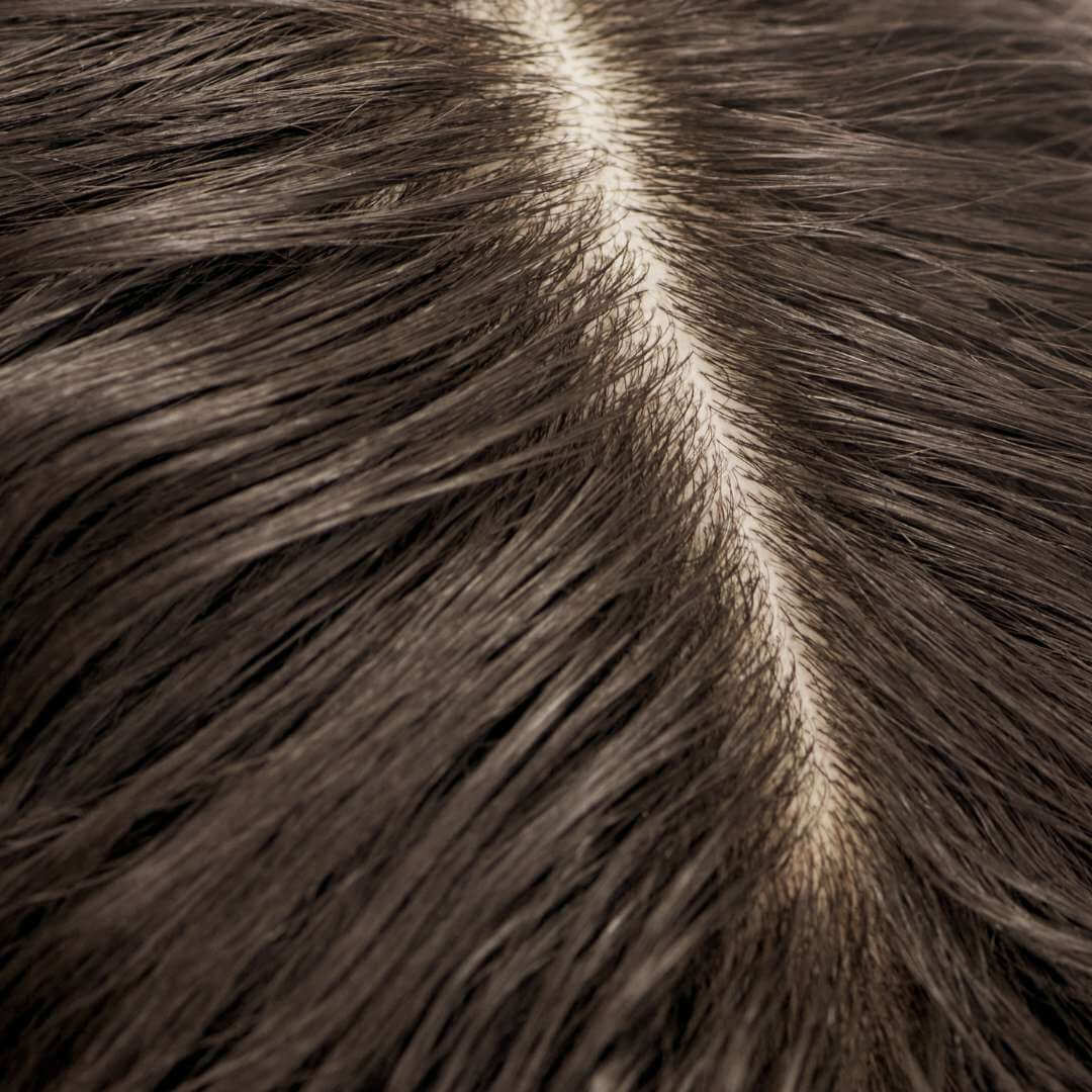 hairline of a woman with brown hair